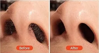 Men's Nose
