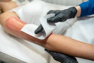 Upper Arms